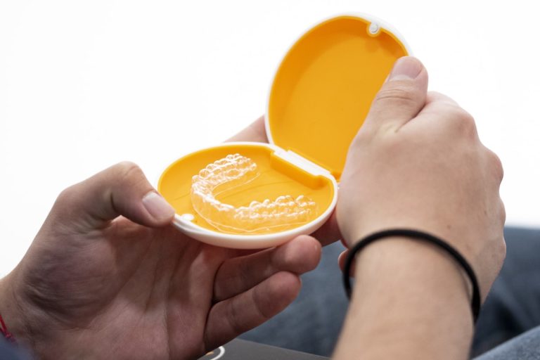 200423 Myaligners 79